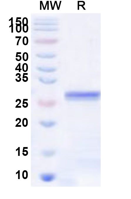 SDS-PAGE for Recombinant Human CHRND Protein, N-His