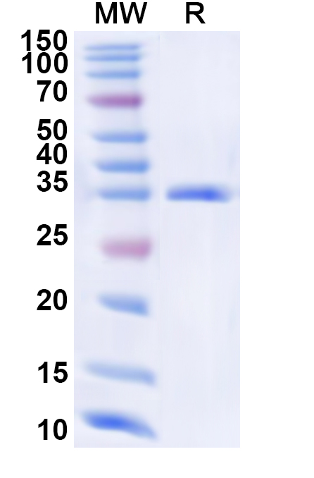 SDS-PAGE for Recombinant Human CLCA4 Protein, N-His
