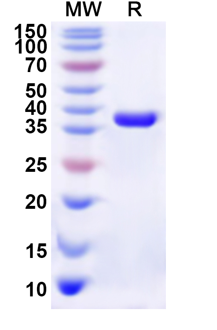 SDS-PAGE for Recombinant Human CLCN2 Protein, N-His
