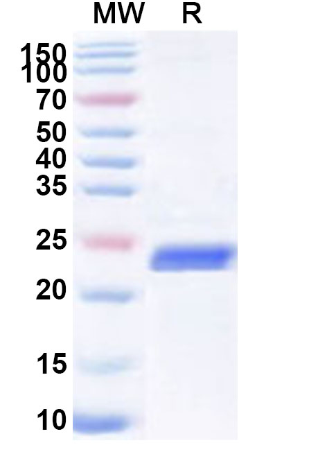 SDS-PAGE for Recombinant Human CLCN3 Protein, N-His