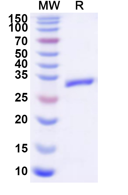 SDS-PAGE for Recombinant Human CLCN6 Protein, N-His
