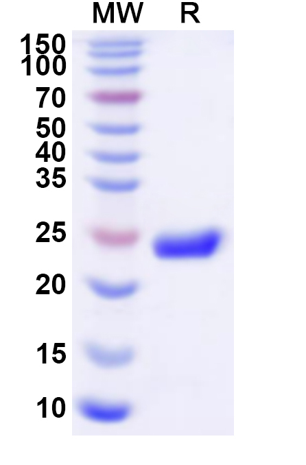 SDS-PAGE for Recombinant Human CLCNKA Protein, N-His