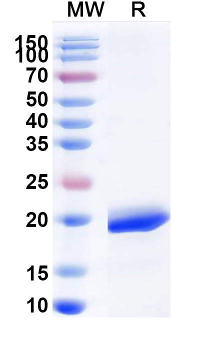 SDS-PAGE for Recombinant Human CLEC2D/OCIL/LLT1 Protein, N-His