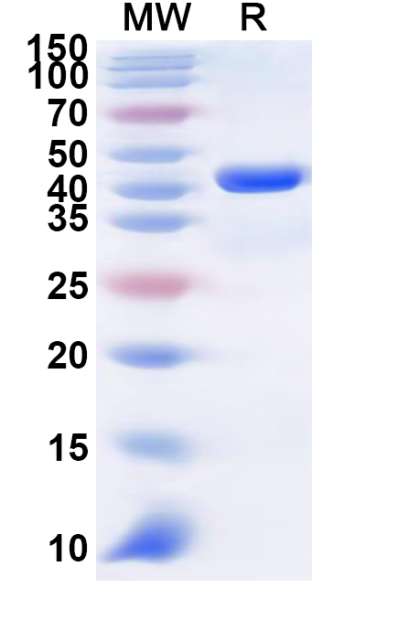SDS-PAGE for Recombinant Human CLPSL1 Protein, N-GST & C-His