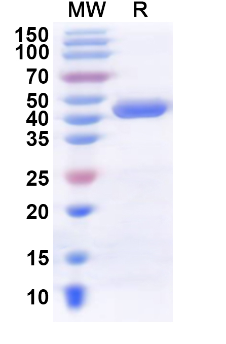 SDS-PAGE for Recombinant Human CMPK2 Protein, N-His