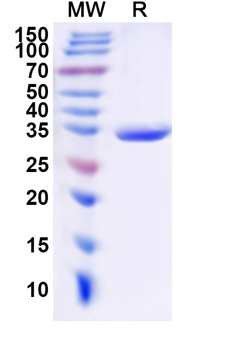 SDS-PAGE for Recombinant Human CNGA1 Protein, N-His