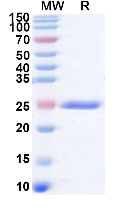 SDS-PAGE for Recombinant Human CNGA3 Protein, N-His