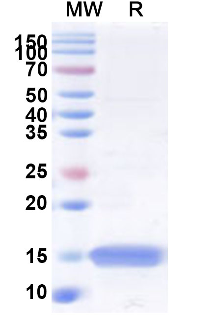 SDS-PAGE for Recombinant Human CNN3 Protein, N-His