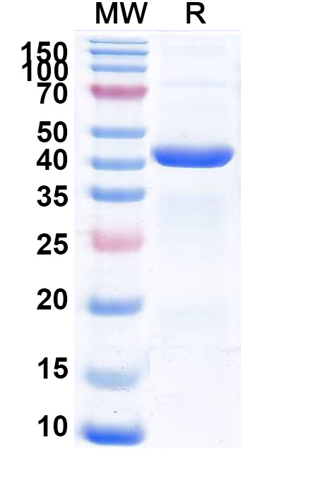 SDS-PAGE for Recombinant Human CNP Protein, N-His