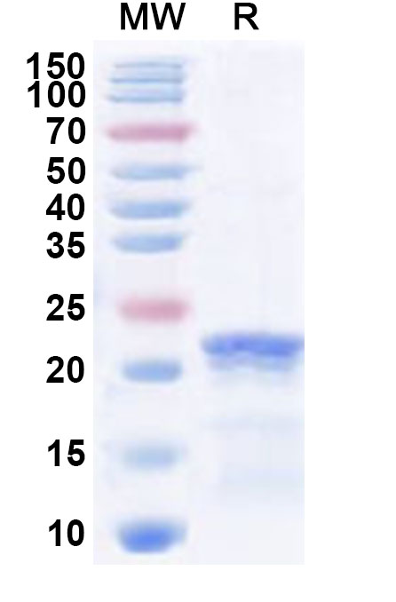 SDS-PAGE for Recombinant Human COL19A1 Protein, N-His