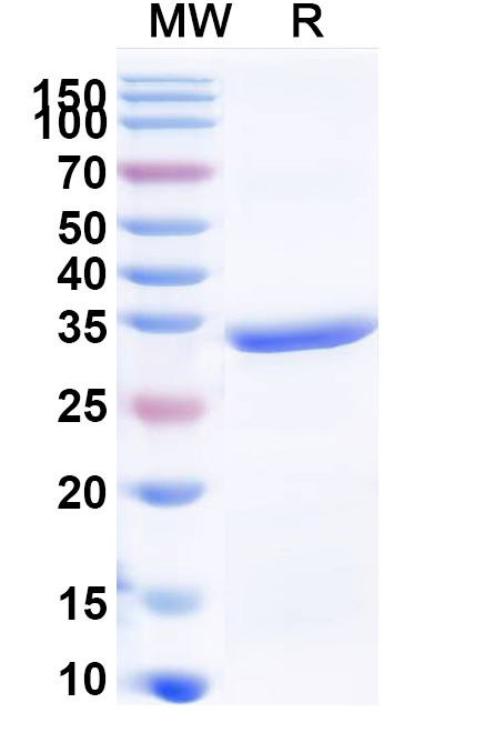 SDS-PAGE for Recombinant Human COL1A2, N-His