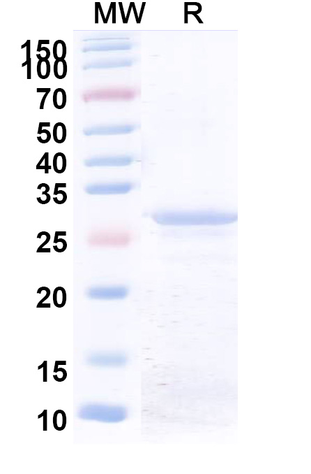 SDS-PAGE for Recombinant Human COL6A1 Protein, N-His
