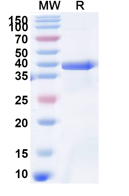 SDS-PAGE for Recombinant Human COL6A2, N-His