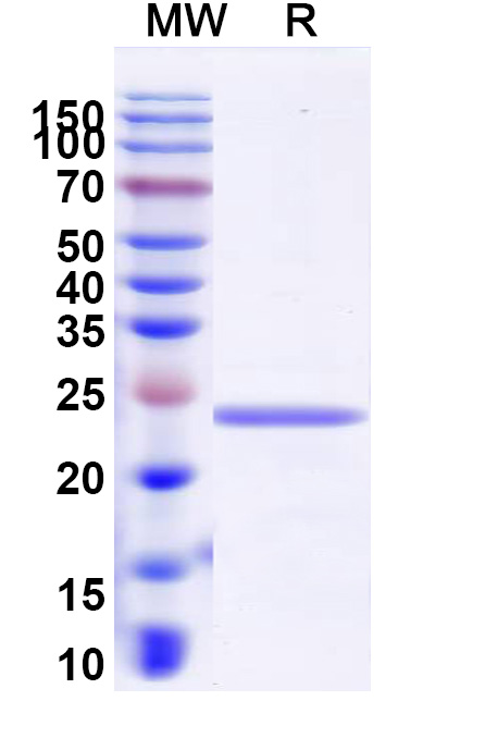 SDS-PAGE for Recombinant Human COL6A3 Protein, N-His