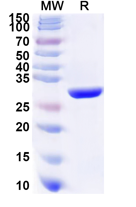 SDS-PAGE for Recombinant Human COL9A1 Protein, N-His