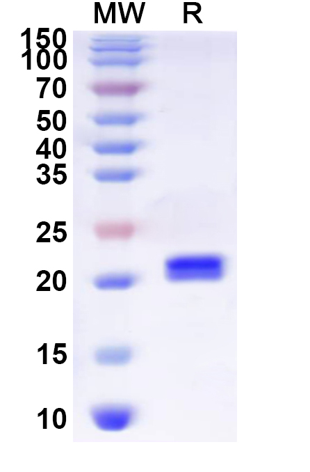 SDS-PAGE for Recombinant Human COLEC12 Protein, N-His