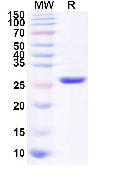 SDS-PAGE for Recombinant Human COPS5 Protein, N-His