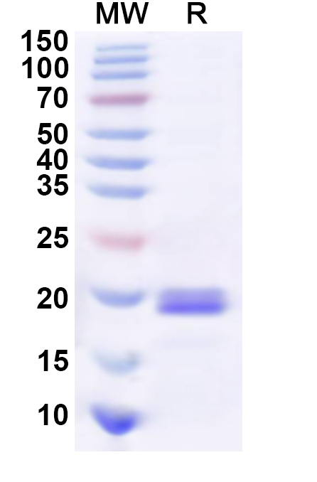 SDS-PAGE for Recombinant Human COPZ1 Protein, N-His