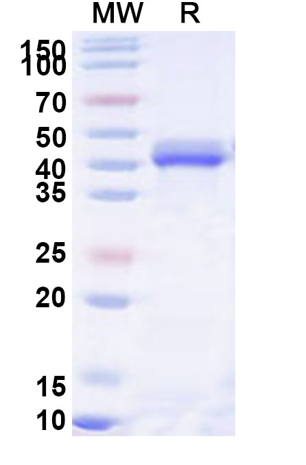 SDS-PAGE for Recombinant Human CORO1C Protein, N-His