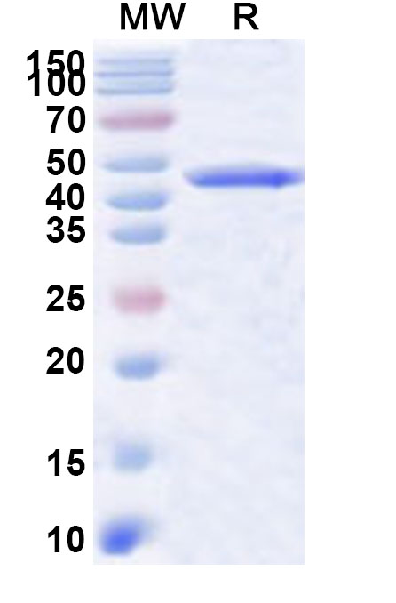 SDS-PAGE for Recombinant Human CPSF1 Protein, N-His