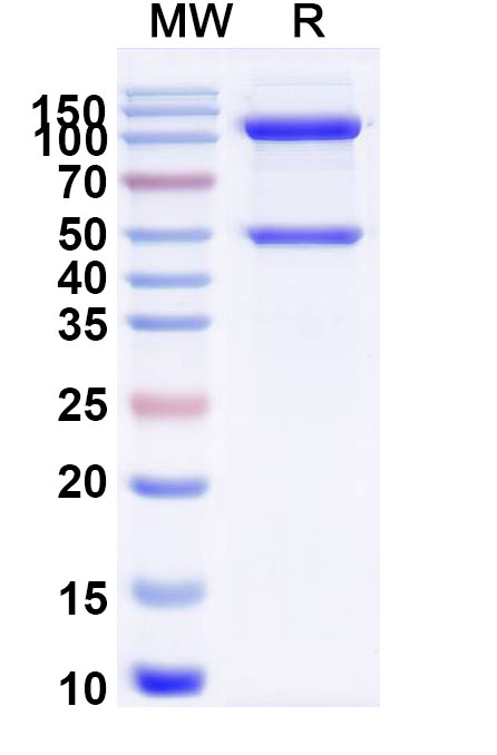 SDS-PAGE for Recombinant Human CRBN & DDB1 Protein, N-Strep & C-His