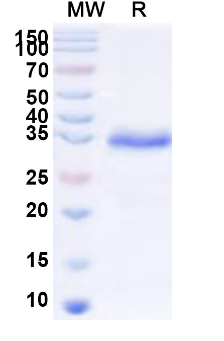 SDS-PAGE for Recombinant Human CREB5 Protein, N-His-KSI