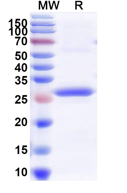 SDS-PAGE for Recombinant Human CRHR2 Protein, N-His-SUMO