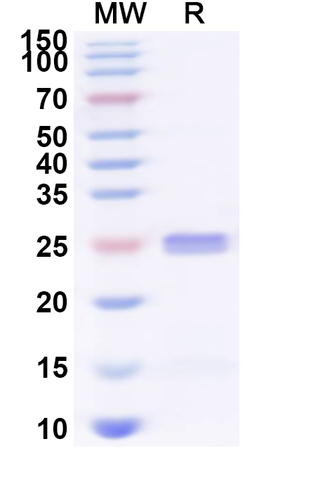 SDS-PAGE for Recombinant Human CRTAM Protein, N-His