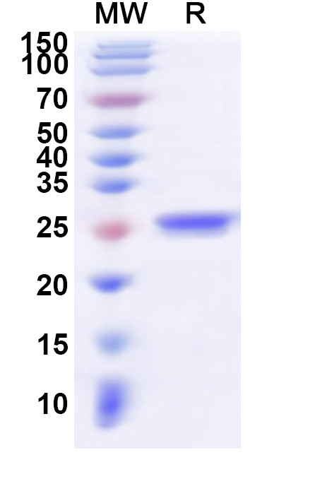 SDS-PAGE for Recombinant Human CRYBB1 Protein, N-His