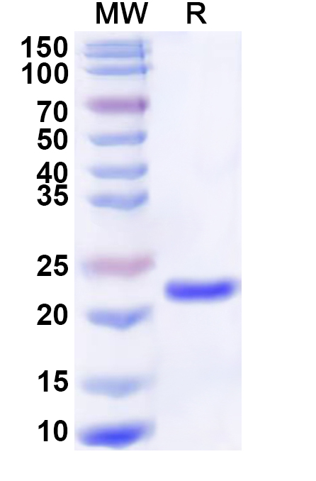 SDS-PAGE for Recombinant Human CRYGS Protein, N-His