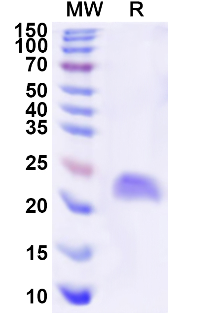 SDS-PAGE for Recombinant Human CSRP3 Protein, N-His