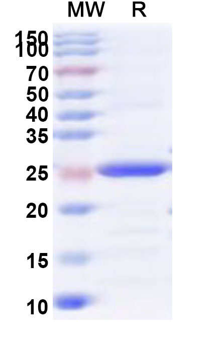 SDS-PAGE for Recombinant Human CSTF2 Protein, N-His