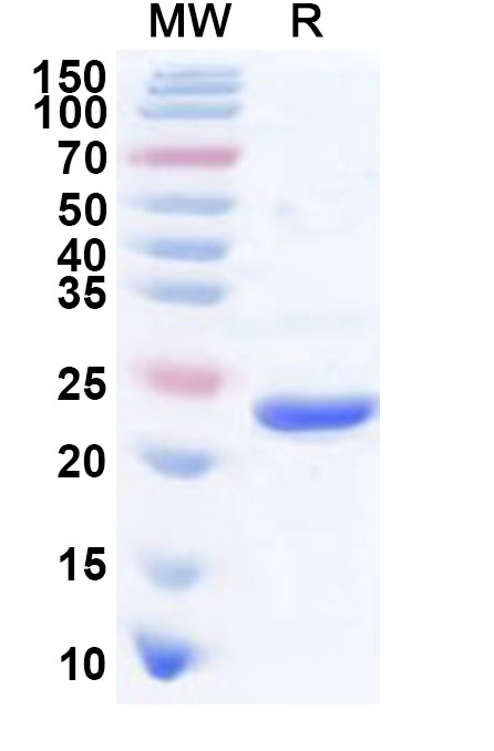 SDS-PAGE for Recombinant Human CTF1 Protein, N-His