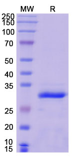 SDS-PAGE for Recombinant Human CYGB Protein, N-His-SUMO