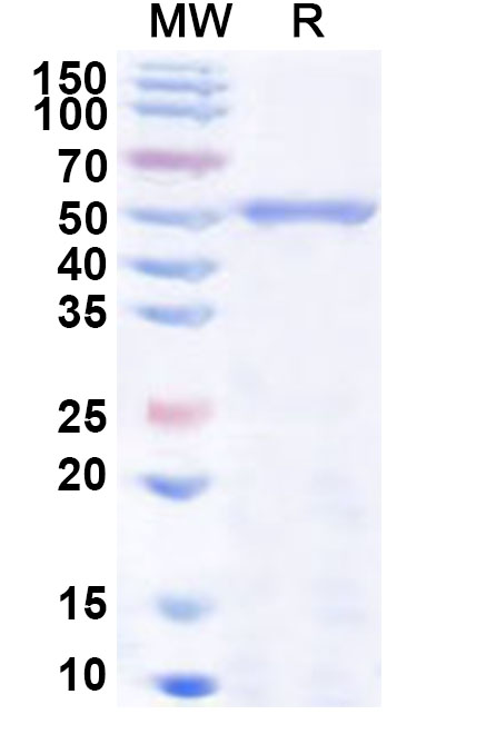 SDS-PAGE for Recombinant Human CYP2C9 Protein, N-His