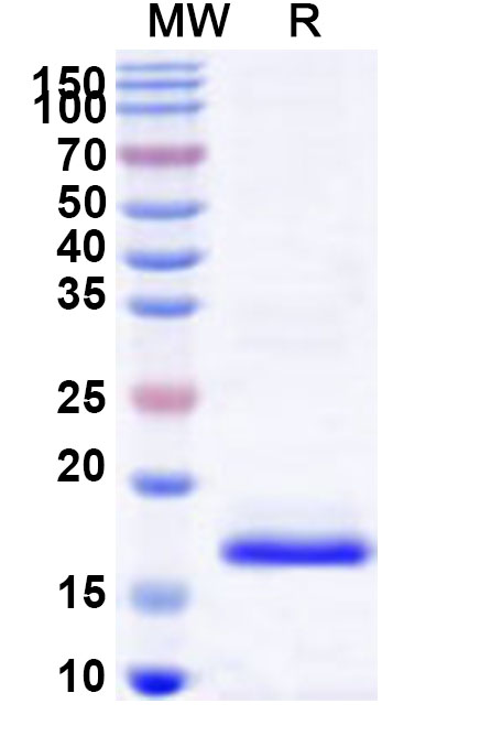 SDS-PAGE for Recombinant Human CYTIP Protein, N-His