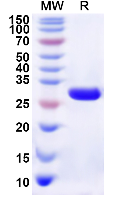 SDS-PAGE for Recombinant Human DAP Protein, N-His-KSI