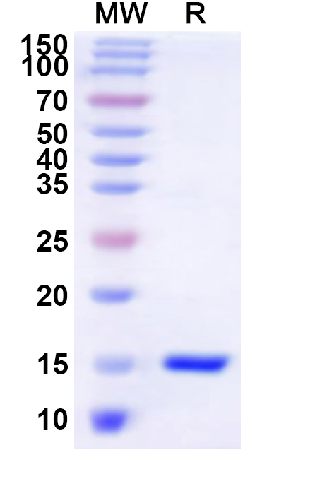 SDS-PAGE for Recombinant Human DAZAP2 Protein, N-His
