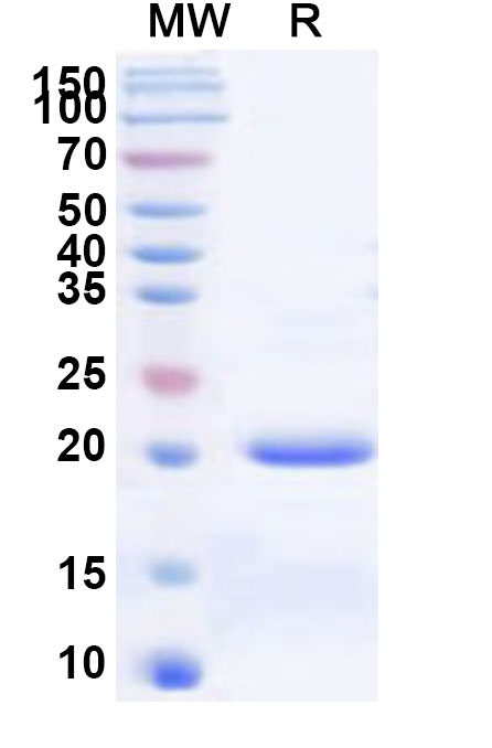 SDS-PAGE for Recombinant Human DCAF15 Protein, N-His