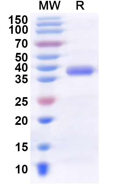 SDS-PAGE for Recombinant Human DCAF6 Protein, N-His