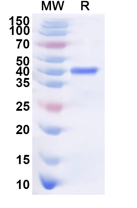 SDS-PAGE for Recombinant Human DCAF8 Protein, N-His
