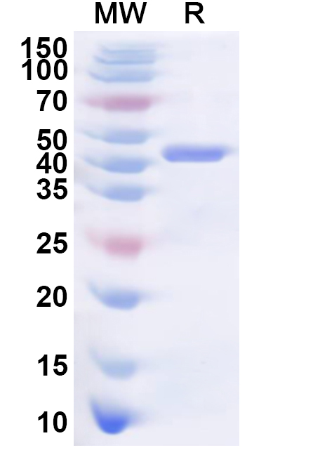 SDS-PAGE for Recombinant Human DDX59 Protein, N-His