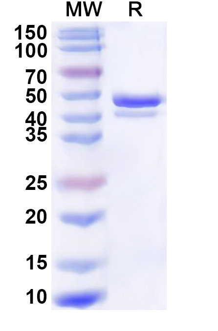 SDS-PAGE for Recombinant Human DDX6 Protein, N-His