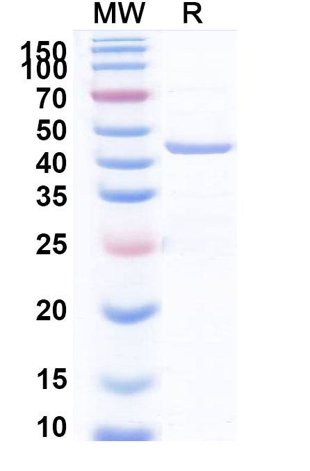 SDS-PAGE for Recombinant Human DFFB Protein, N-His