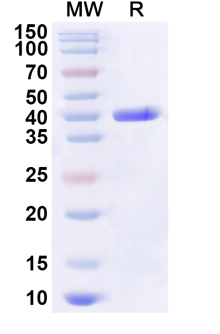 SDS-PAGE for Recombinant Human DGCR6 Protein, N-His-KSI