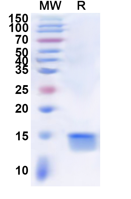 SDS-PAGE for Recombinant Human DLGAP5 Protein, N-His