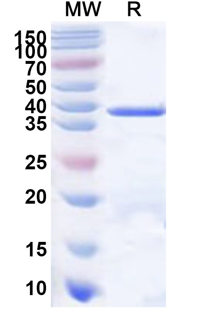 SDS-PAGE for Recombinant Human DMGDH Protein, N-His