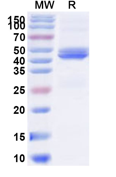 SDS-PAGE for Recombinant Human DMPK Protein, N-His