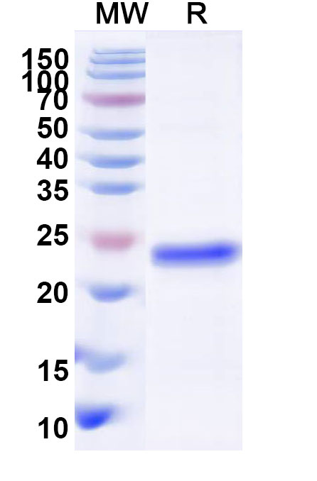 SDS-PAGE for Recombinant Human DNMT1 Protein, N-His