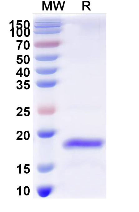 SDS-PAGE for Recombinant Human DNMT3B Protein, N-His